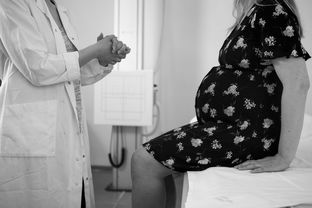 CT片上的惊人相似，25岁72岁62岁三人的CT片几乎一样